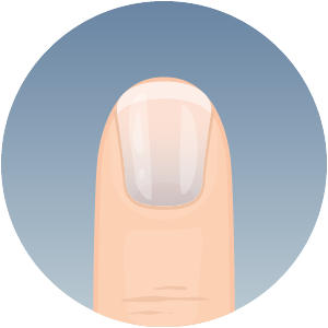 all-tenet-fingernails-clue-300x300-2024-04 Fingernail showing nail discoloration changes